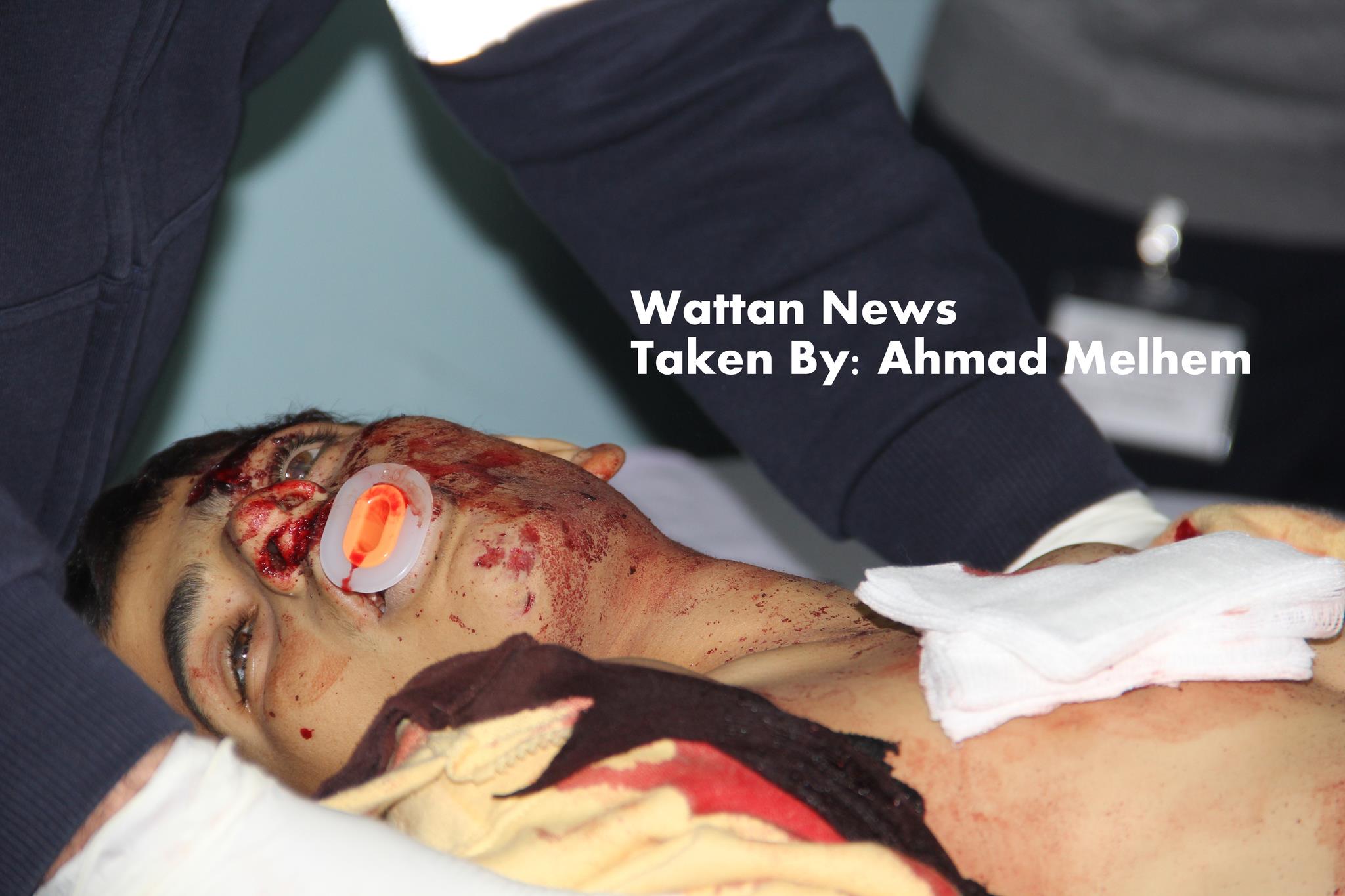The IOF killed Sameer Awad 17 years old in Budros near Ramallah